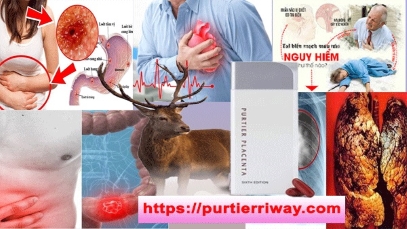 Tại Sao Phải Sử Dụng Liệu Pháp Tế Bào Gốc Purtier Placenta